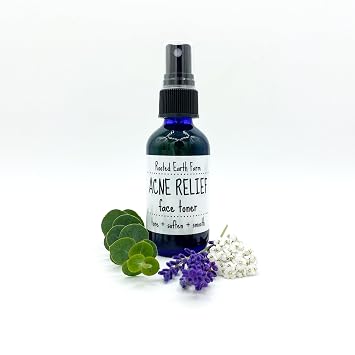 Acne Toner - 2 fl oz - Astringent for Face - Natural and Herbal Infused