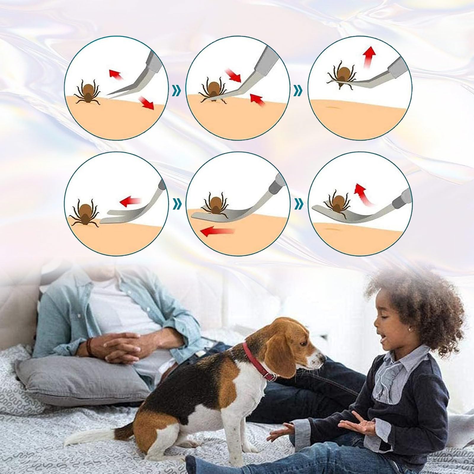 Crochet Tiques, Tique Remover Crochets à Tique avec 3 Ensemble de Qualité Professionnelle en Acier Inoxydable - Facile Supprimer Tiques