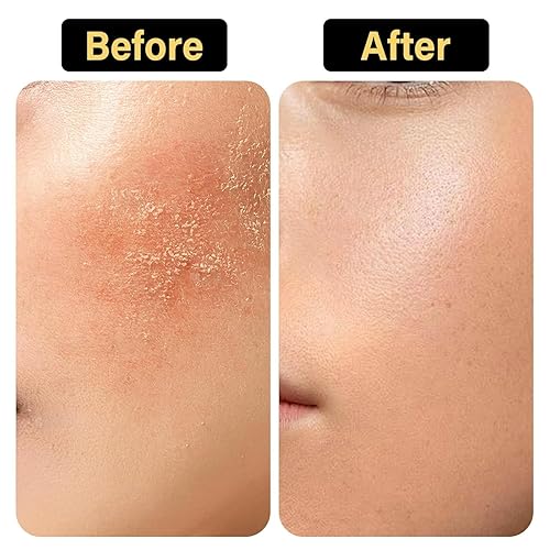 Miniatura 4 de Sarga de ternera batida para la piel, 4.05 onzas, 100% orgánico alimentado con pasto para la cara, miel y bálsamo de sargo puro, sebo de res,