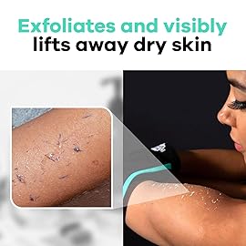 Dermasuri - Deep Exfoliating Glove - Korean Exfoliating Mitt - Body Scrubber for Shower - Buffs Dry & Dead Skin - Keratosis Pilaris Treatment Scrub - Stocking Stuffer Gifts for Women & Men - Teal Mitt
