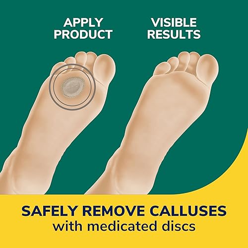 Miniatura 9 de Dr. Scholl's Removedor de callos extra grueso, 4 unidades  Ayuda a suavizar callos duros y cojines para aliviar el dolor durante todo el día