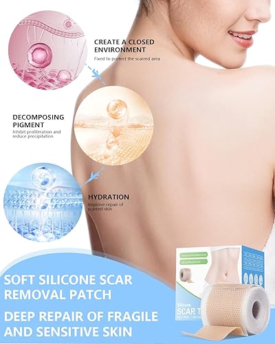 Miniatura 7 de Hojas de silicona para cicatrices, cinta de silicona para cicatrices, rollo de 1.6 x 60 pulgadas, tratamiento de eliminación de cicatrices, cinta de