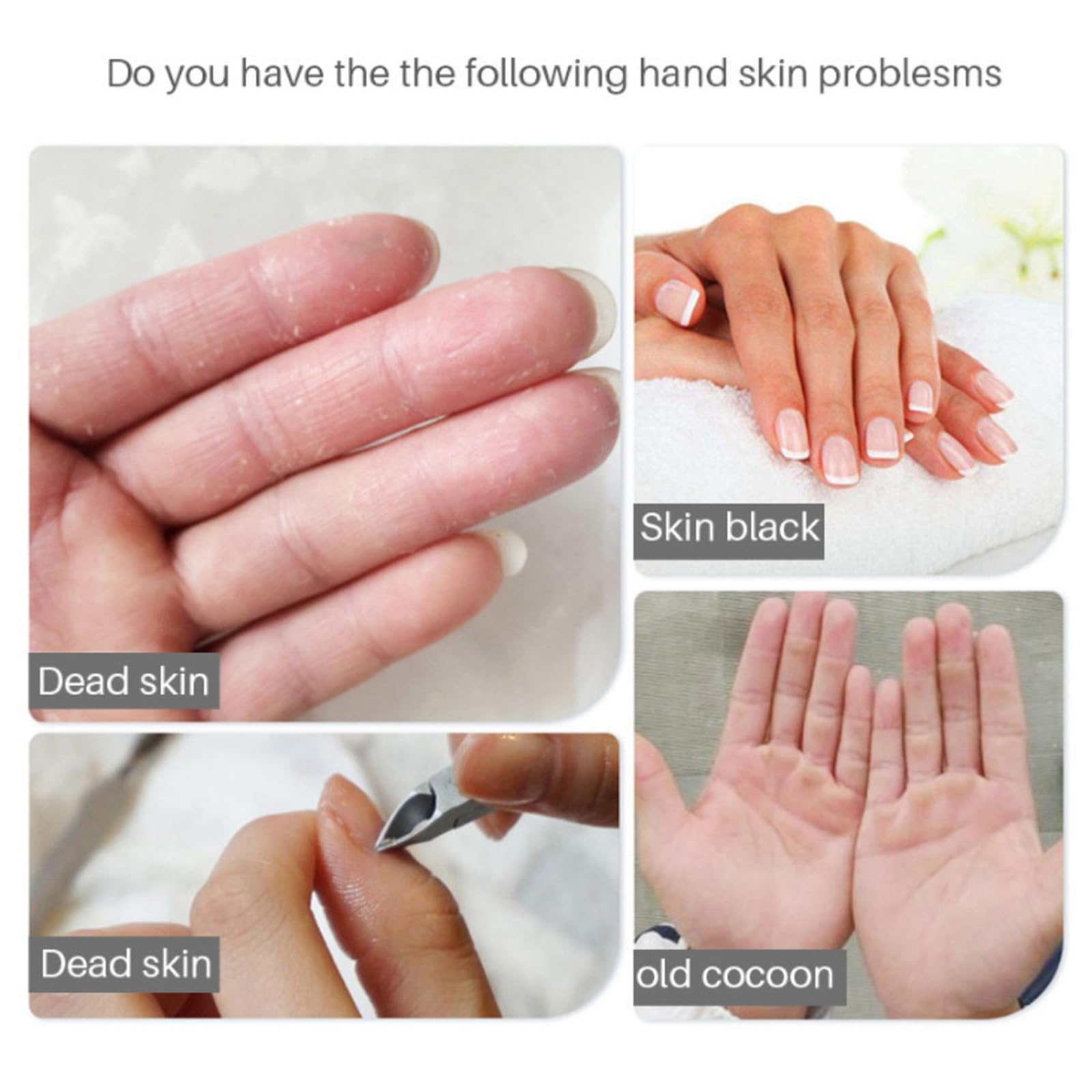 Maschera Per Le Mani, 5 Paia Maschera Idratanti Per Mani Esfoliante, Guanti Idratanti per la Sbiancamento Cura delle Mani, Per Mani Secche, Invecchiate e Screpolate, per Donne e Uomini