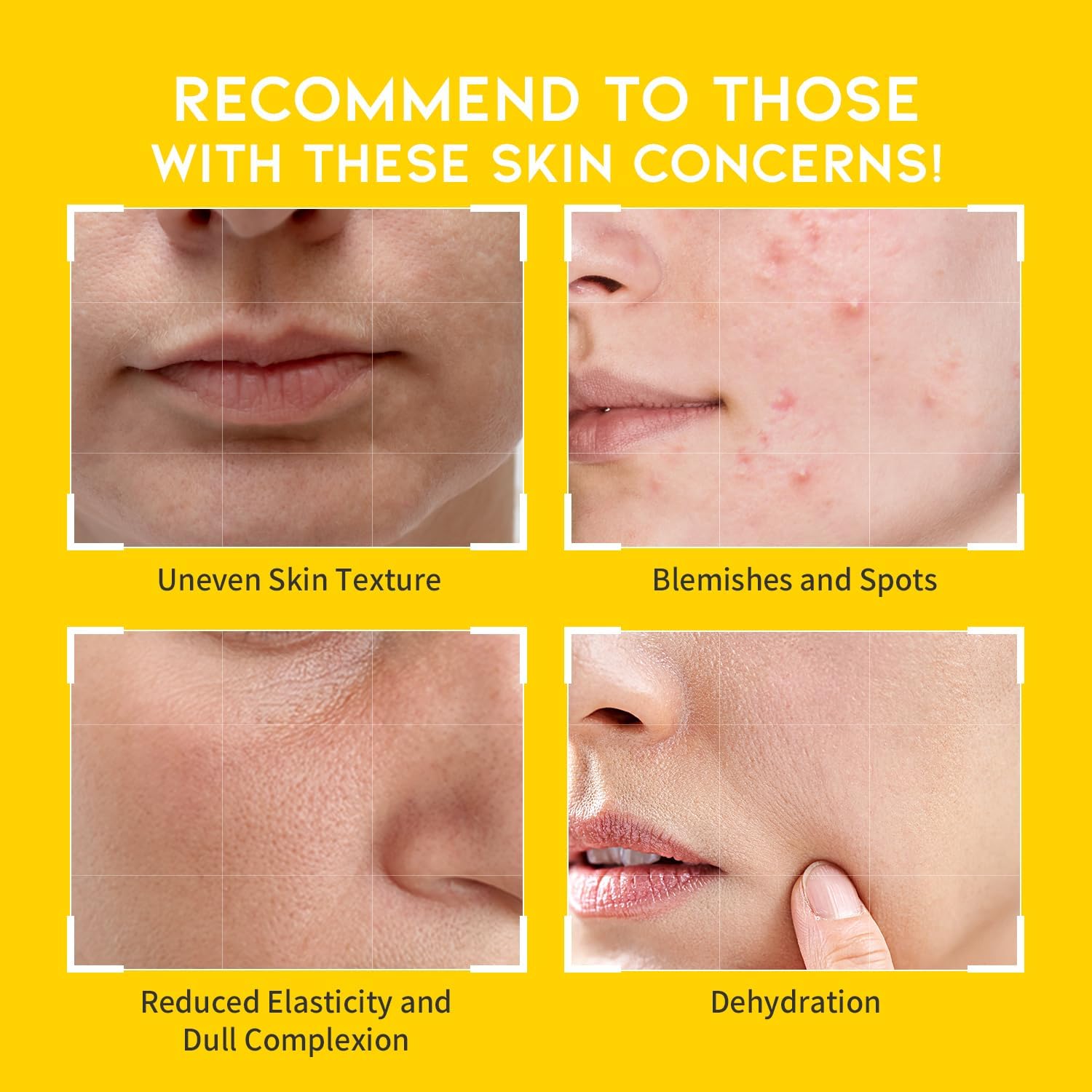 Boosting Toner Pads for Face Oily Skin Korean, #OOTD Vitamin C Niacinamide Heartleaf Hydrating Calming Redness, Vitamin C Toner Pad 70Pads 4.05oz 120ml image 4 of 7 B0DDPCNK38