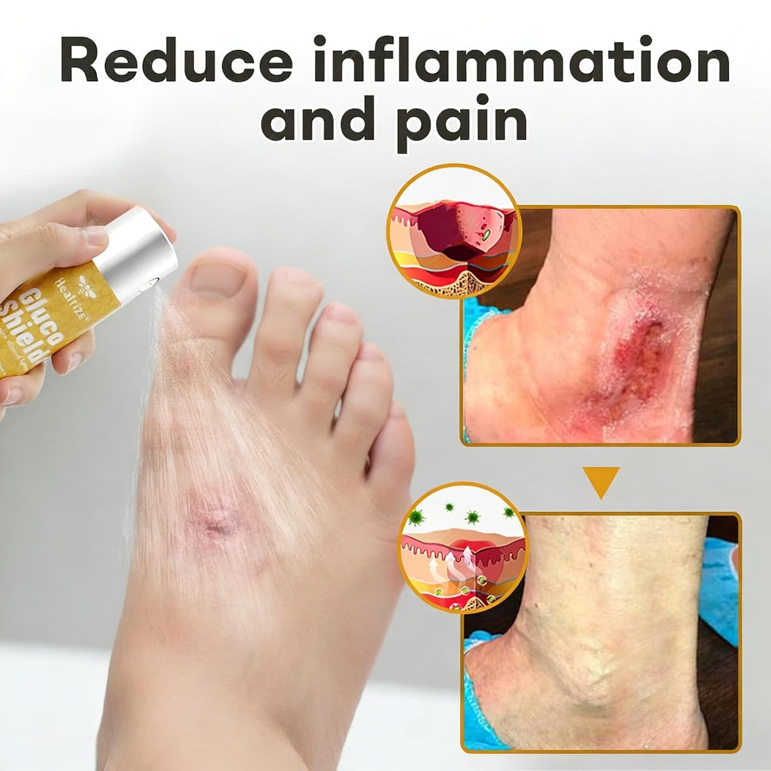 Healrize GlucoShield Bee Venom Spray, Healrize Bee Venom Spray, Deeply Moisturizes The Skin (2PCS)