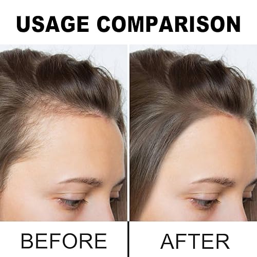 Miniatura 4 de Divine Vitals Aceite de batana para el crecimiento del cabello, 100% puro y natural de Honduras, aceite de pérdida de cabello Batana Miracle para