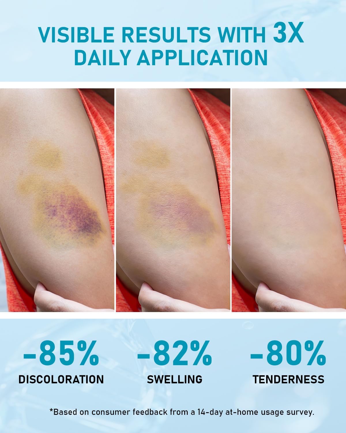 Arnica Bruise Cream Extra Strength: Soothing Moisturizer with Vitamin K, C & E for Bruising, Swelling, Discoloration & Thin Skin - Daily Care for Bruises, Mature & Thin Skin (3 Oz * 2 PCS)
