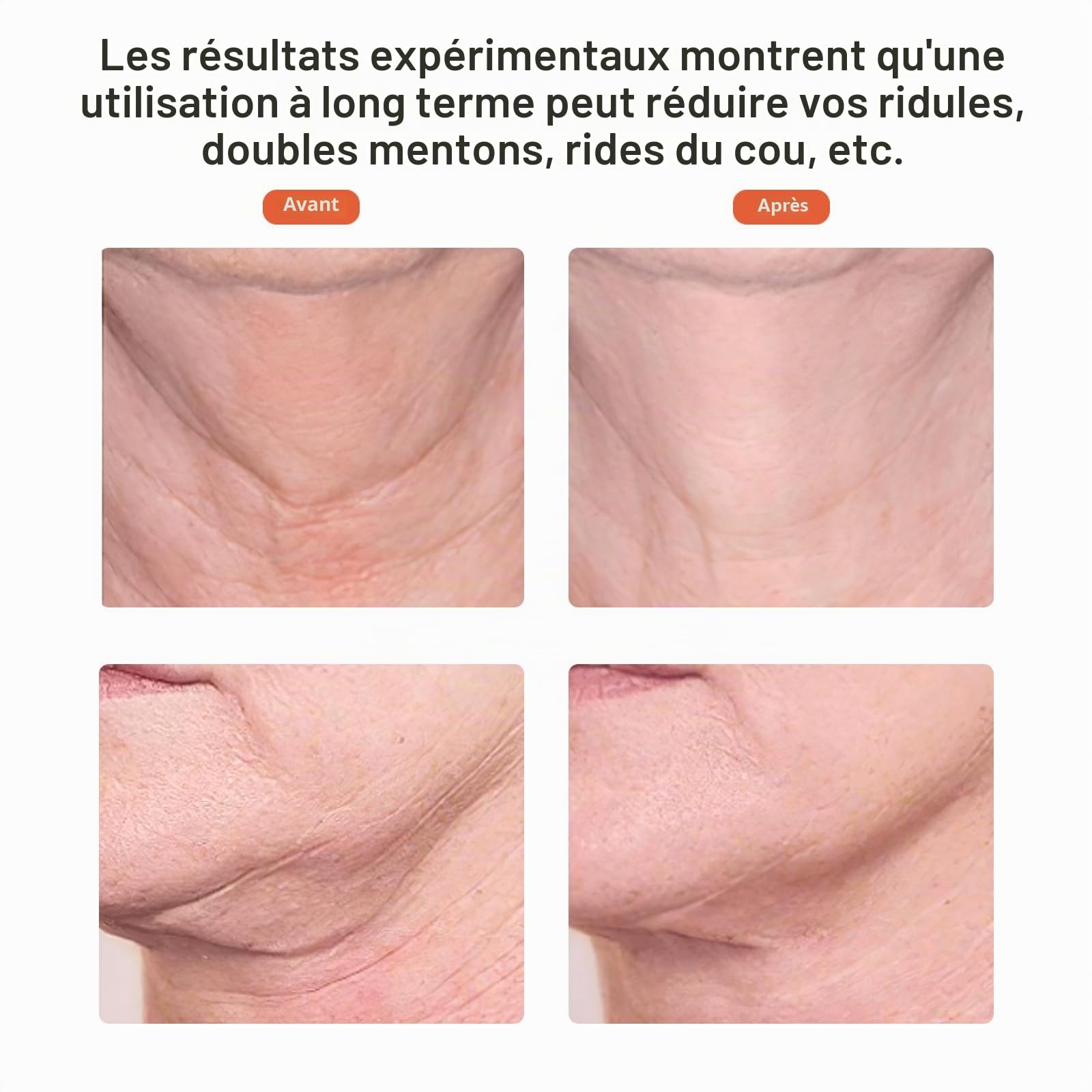 Ms.W Appareil Anti-Rides et Lifting Visage, Massage et Soin Anti-âge, Tonification et Raffermissement du Cou, Réduction des Pores, Rechargeable