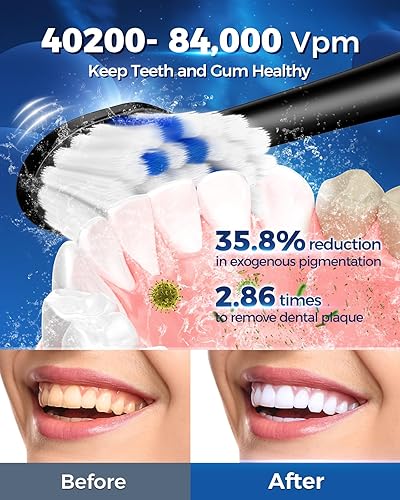 Miniatura 5 de Cepillo de dientes eléctrico para adultos con 6 modos y 5 niveles de intensidad, cepillo de dientes sónico de 84000 rpm con cabezales de cepillado