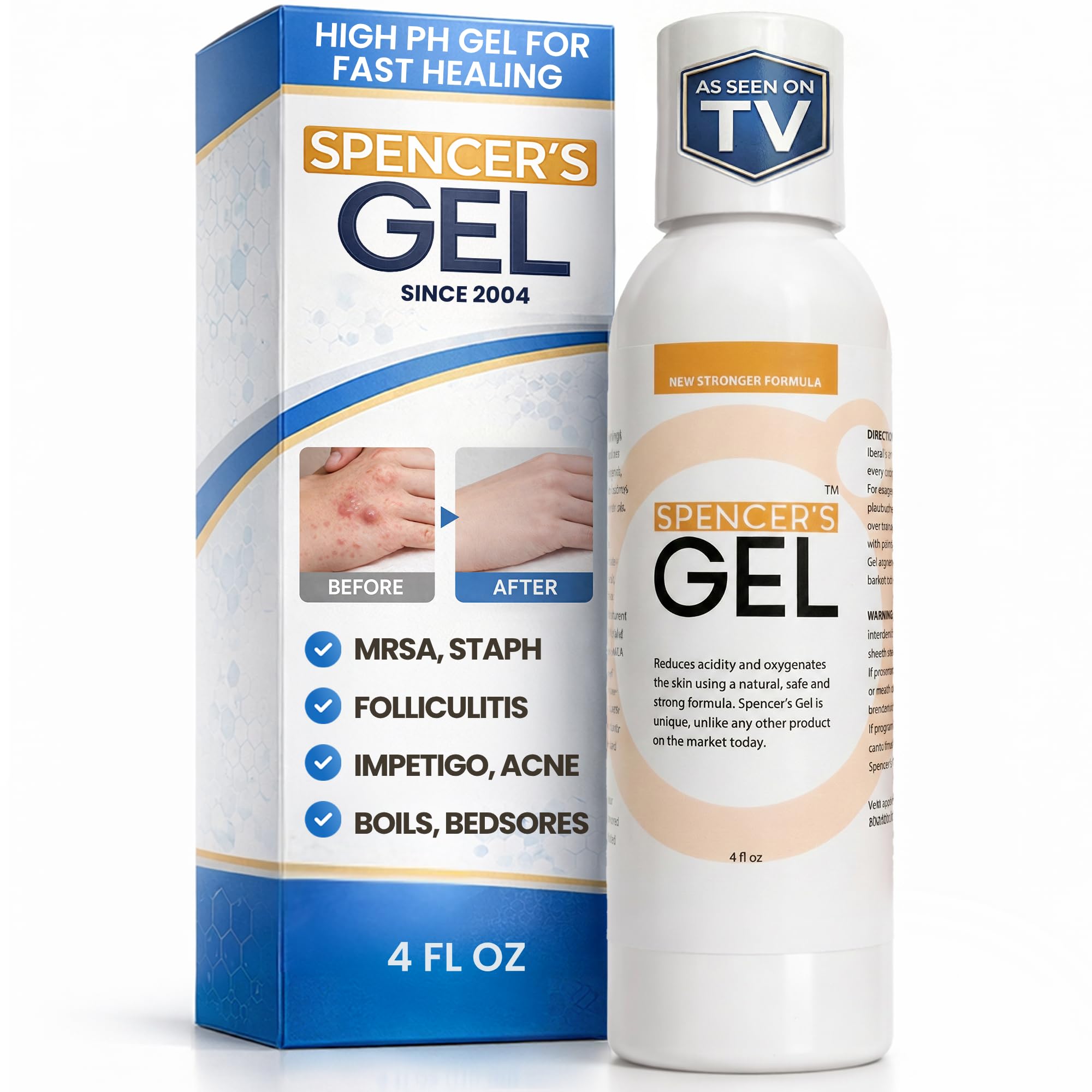 Spencer's Gel alcalino Fórmula – Certificado en laboratorio para matar el estafilo en contacto con la piel, 4 Ounce Bottle Spencer's Gel