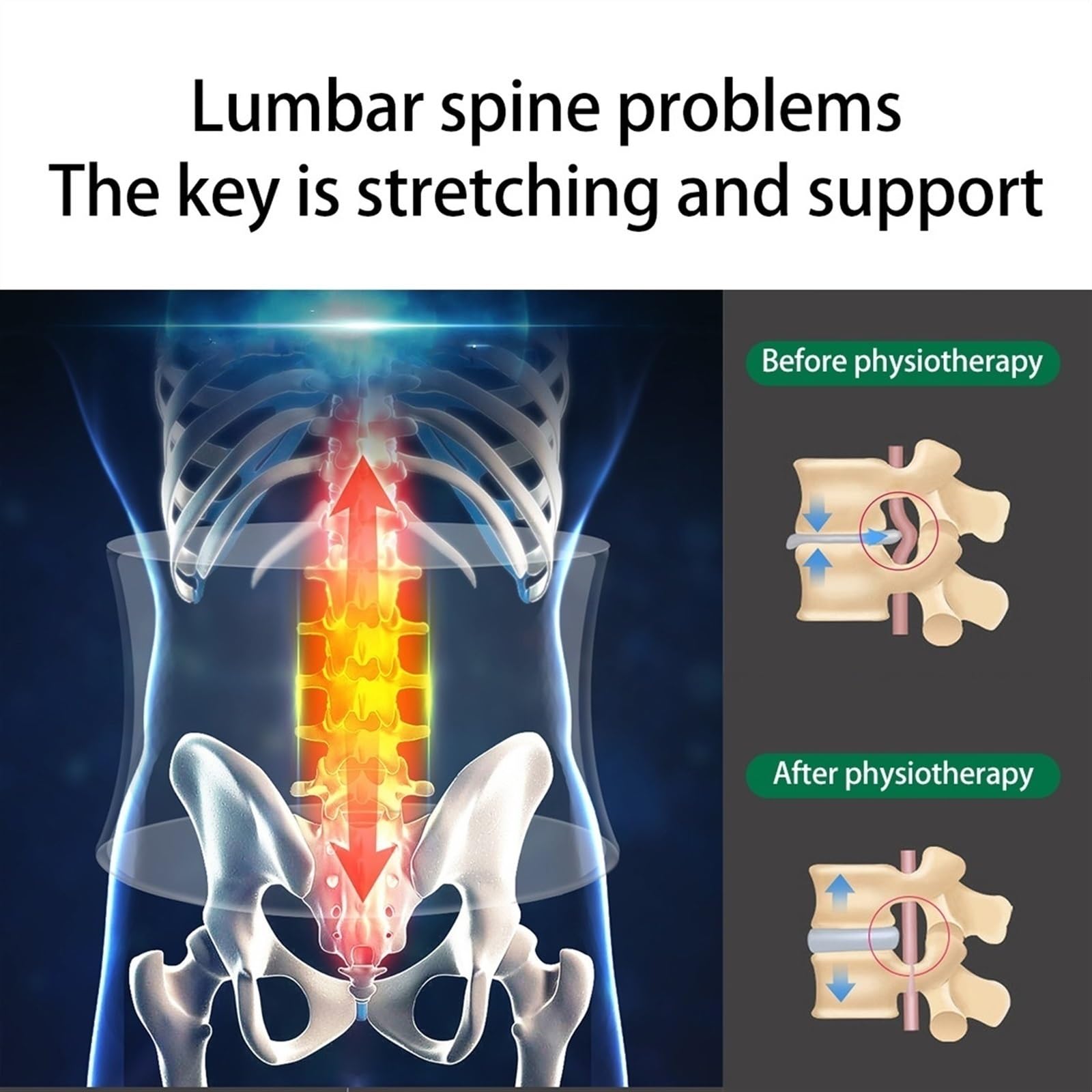 Cintura di decompressione Cinghia posteriore di sostegno lombare Cinghia regolabile di massaggio dell'aria della schiena della vita vertebrale per Sciatica Herniated Back Pain Relief ( Size : S )