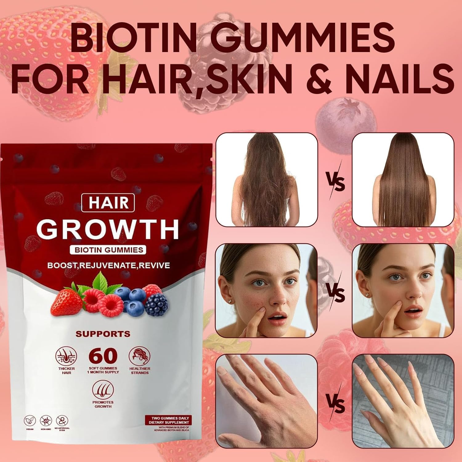 Hair Growth Gummies – with Biotin, Vitamin C & E, Rosemary, Saw Palmetto – Supports Healthy Hair Growth & Strength, Skin & Nail Care – Mixed Berry Flavor, 60 Gummies (1)