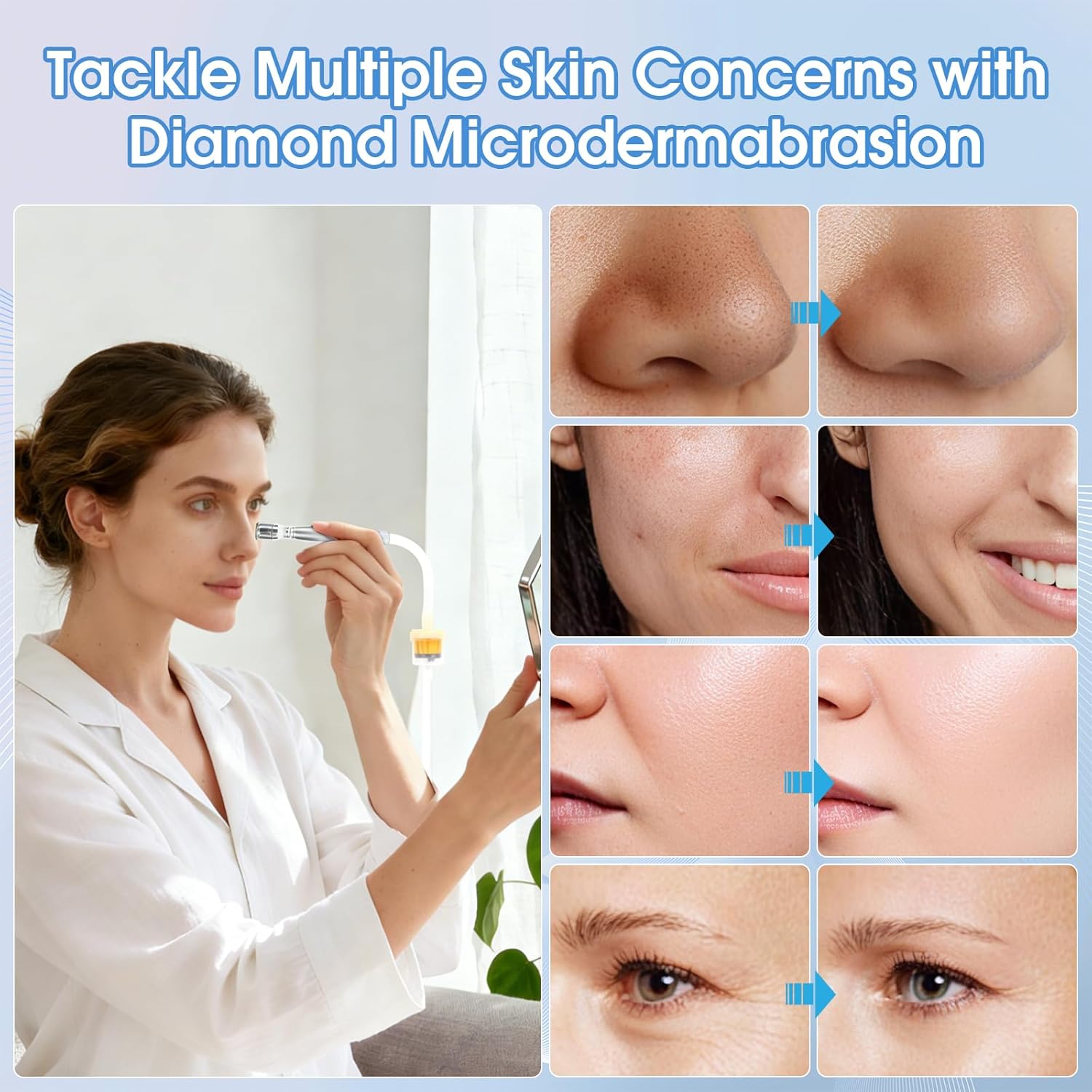 Pro Cordless Microdermabrasion Machine, Beauty Star Portable Facial Pore Vacuum Tool for Blackhead Removal, Glowing Skin, 3 Diamond Tips & 9-Setting Suction, Home and Salon Use - Image 6