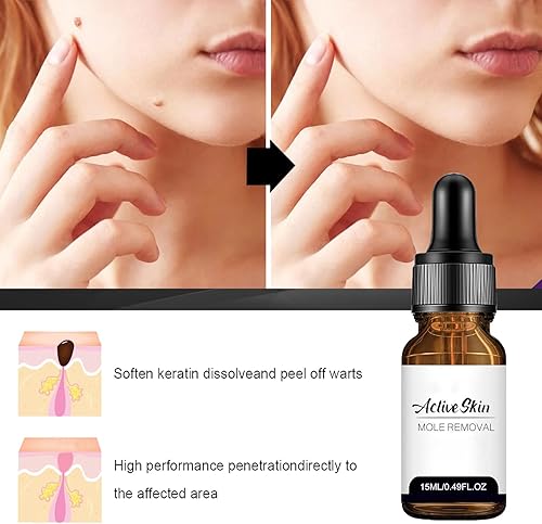 Miniatura 4 de Befada Removedor de marcas cutáneas para cara y cuerpo  Eliminador de verrugas de acción rápida con gotero preciso, objetivos para callos, verrugas