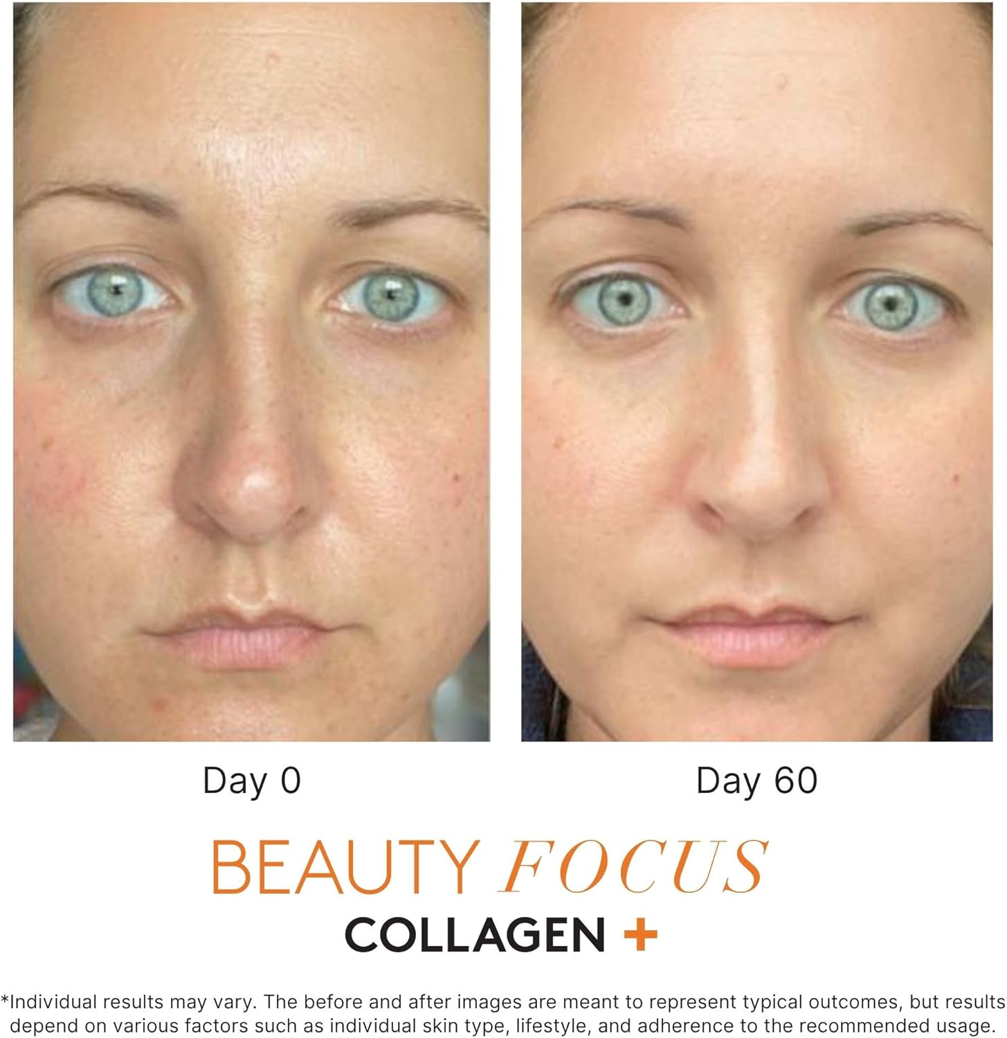 Beauty Focus Nu Skin Collagen+ Powder Mix-in | Citrus-Flavored Collagen Peptides with Lutein & Acerola Cherry | Supports Skin Elasticity, Tone & Texture | 30 Servings