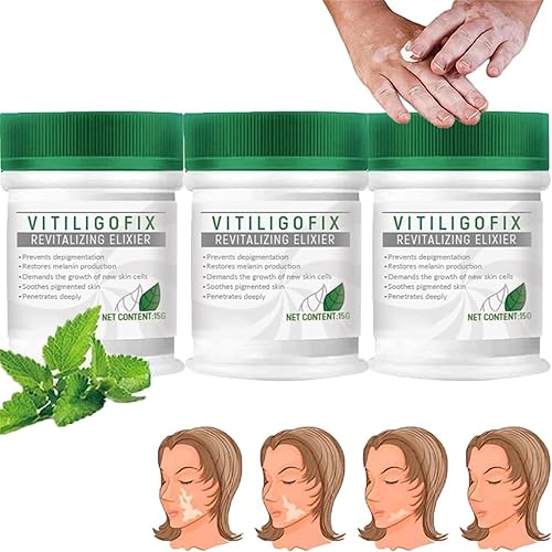 Vitiligo Fix Revitalize Elixir,2023 Nueva crema de tratamiento de vitiligo,Crema calmante para vitiligo,Crema hidratante para el vitíligo de la