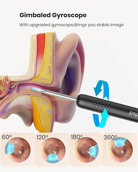 BEBIRD R1 Ear Wax Removal Tool:Ear Cleaner with HD Ear Camera FSA, Black | Solve earwax buildup Removel - 10 replacement tips for various needs - HD visual with led & silicone 3-piece set ensures safe