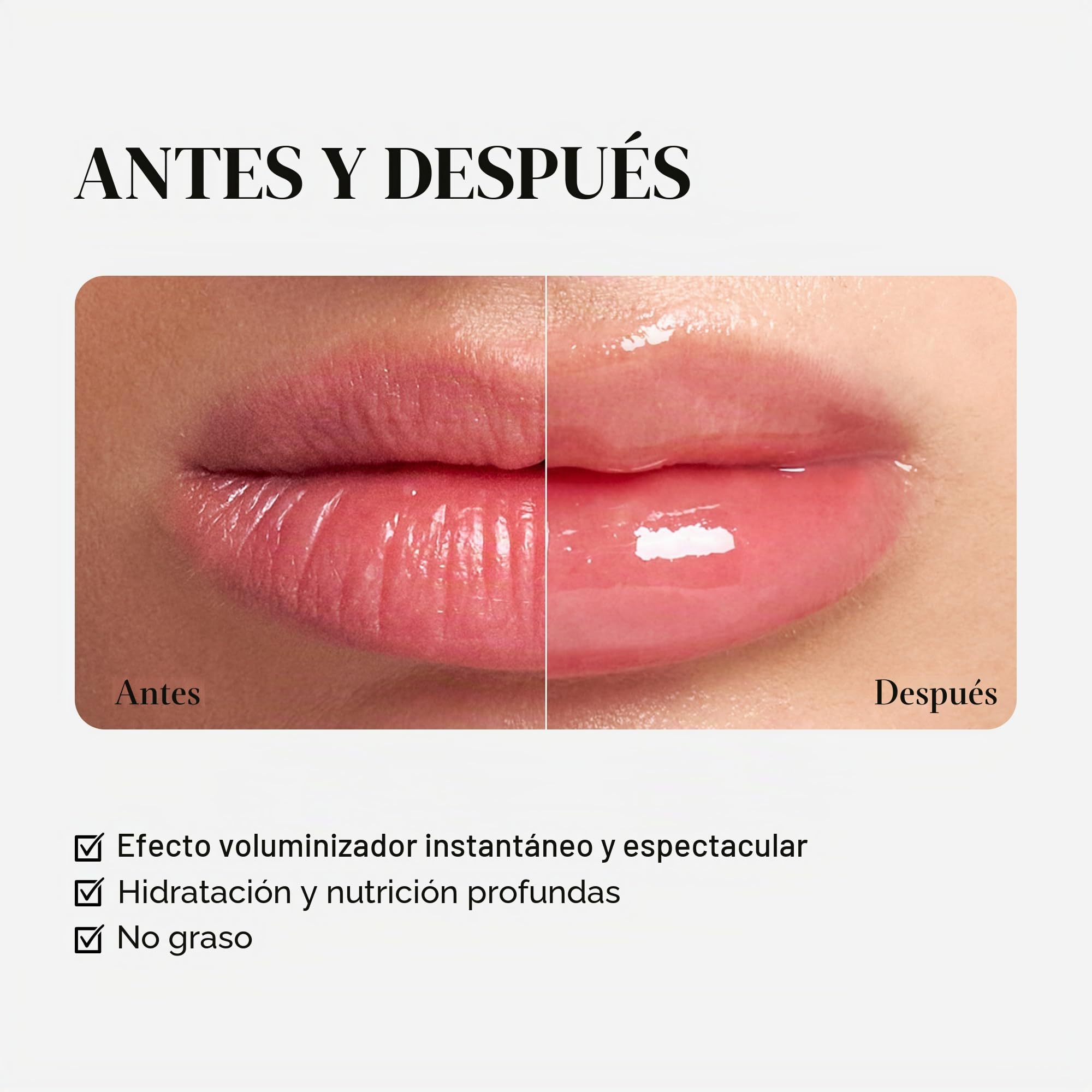 VT COSMETICS Reedle Shot Rellenador de Labios, 4.3 g (0.15 oz), Hidratante, Transparente, Brillo Labial, Sin Fragancia, Cosmética Coreana (Experto)