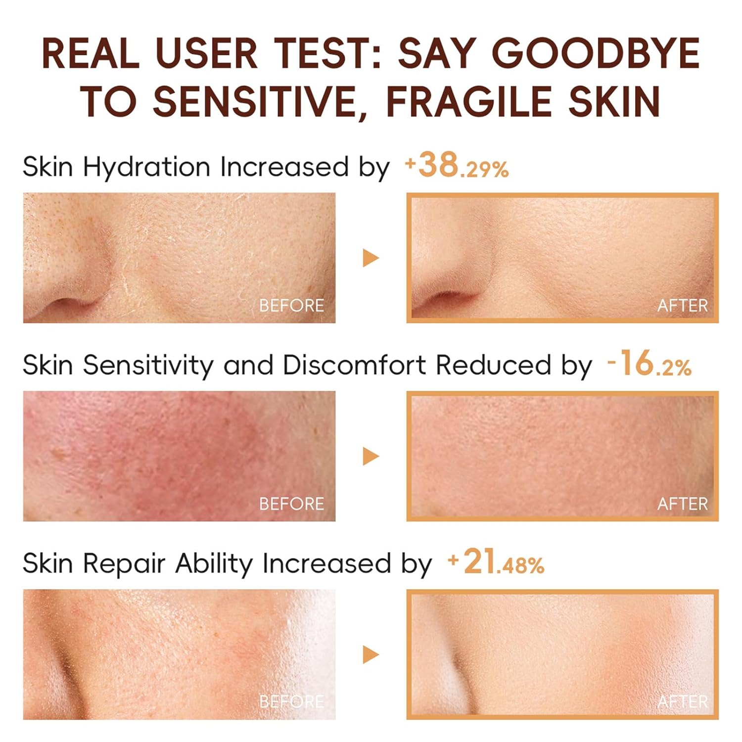 Rice Skincare Set for Teen Girl Gifts Birthday - Skin Care for Teens 10-12 - Hydrating Skin Care Routine Kit for Women - Gifts Birthday Facial Kit for Women - Skin Care Set with Cleanser,Serum - Image 6