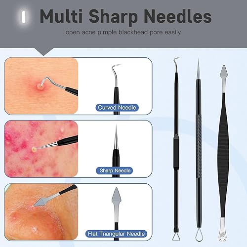 Miniatura 3 de Kit de herramientas profesional para reventar, 10 pinzas para eliminar puntos negros, kit de eliminación de acné para una fácil extracción de