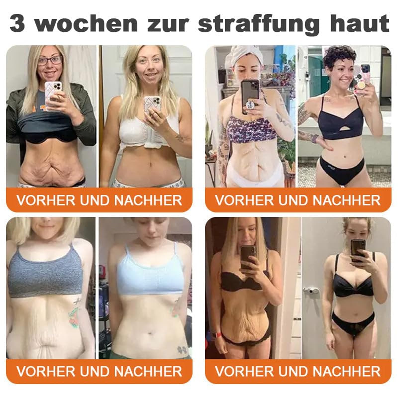 Spzv Bienengift StraffendeSerum Stick, Fortschrittliches Bienengift Straffende Creme Hautfeuchtigkeit, Spzv Bienengift Stick Sanfte Faltenentfernung für jeden Hauttyp (1)