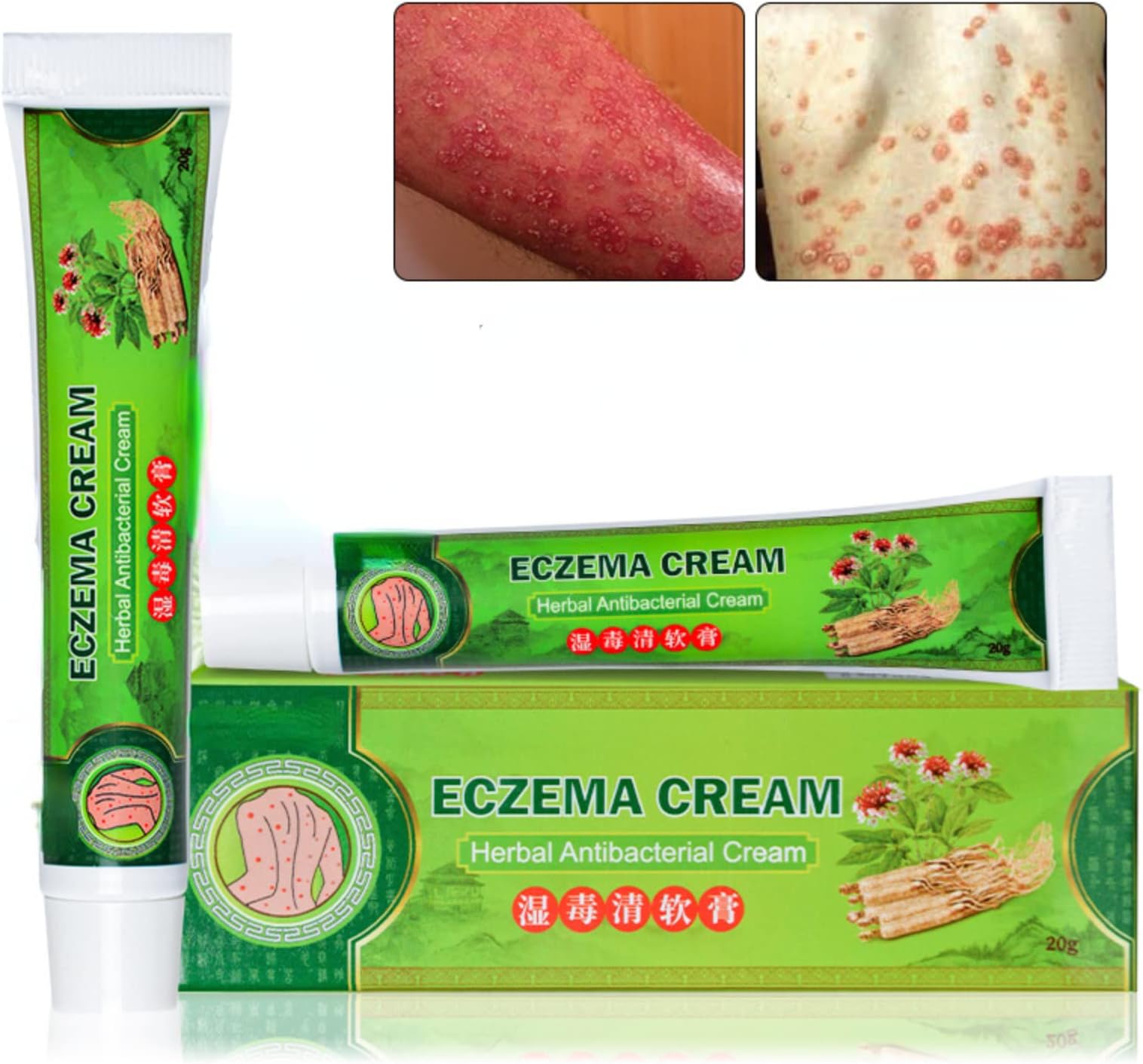 2 pcs Chinese Herbal Eczema, Psoriasis Creams Dermatitis and Eczema Pruritus Psoriasis Ointment