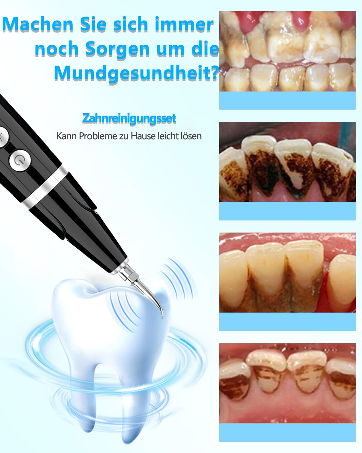 Zahnsteinentferner mit LED, Zahnreinigungsset für Hunde/Katzen und Hause, Elektrische Zahnreinigung Set mit 5 Modi und 3 Reinigungsköpfe, USB-C, IPX 7