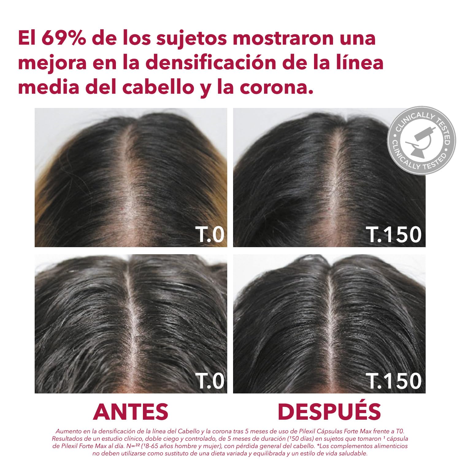 PILEXIL Pack 90 Cápsulas Anticaída Forte Max + Champú Triple Protection 100 ml
