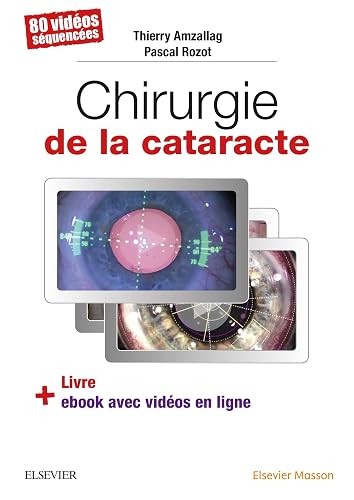 Chirurgie de la cataracte: 60 Videos Sequencees