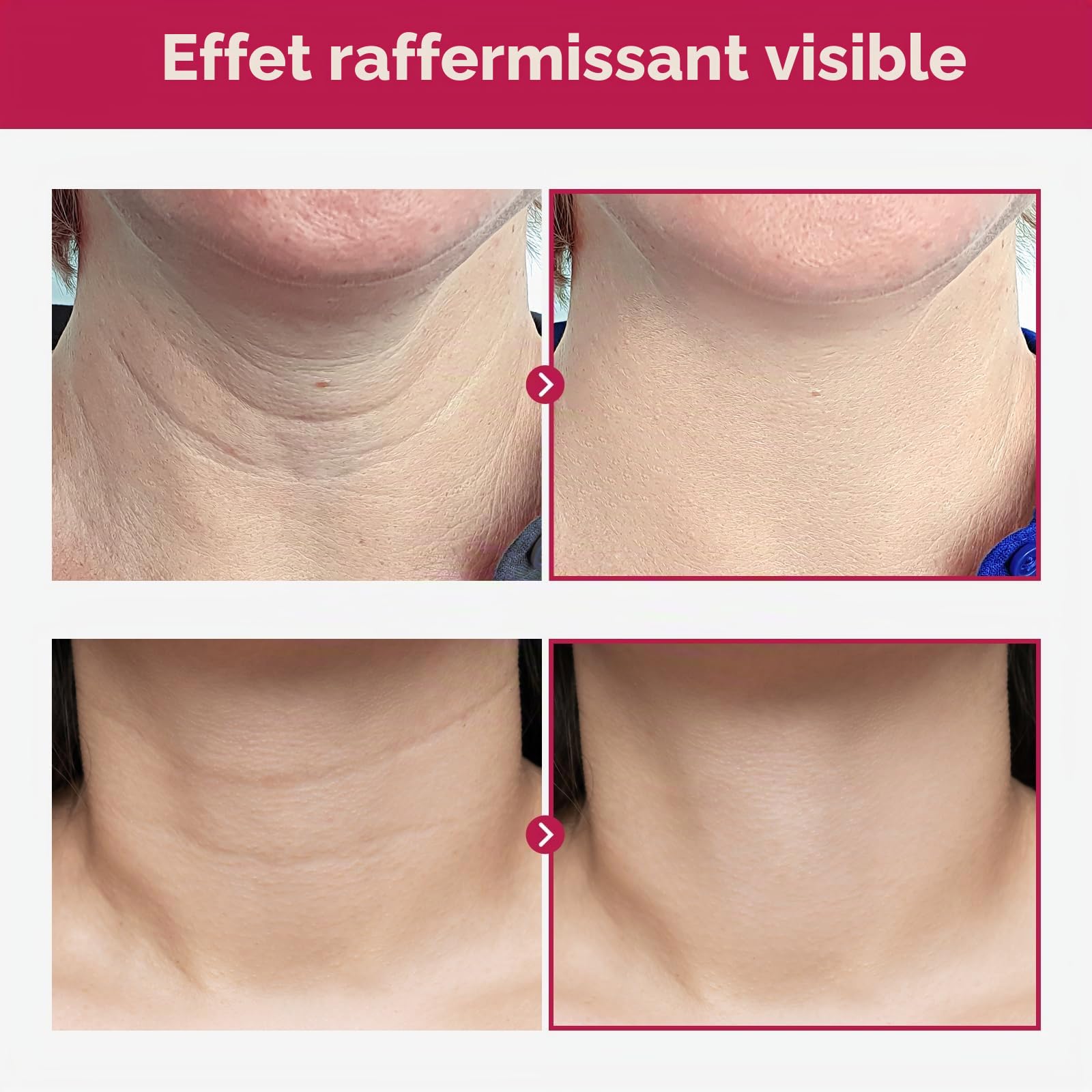TOSOWOONG Crème Cou et Décolleté Collagène Necktox, Fermeté et Rides | Collagène, Acide Hyaluronique, Anti-Âge, Élasticité, Ridules, Peau Relâchée, Fini Rosée, Hydratant, K-Beauty, 50 ml