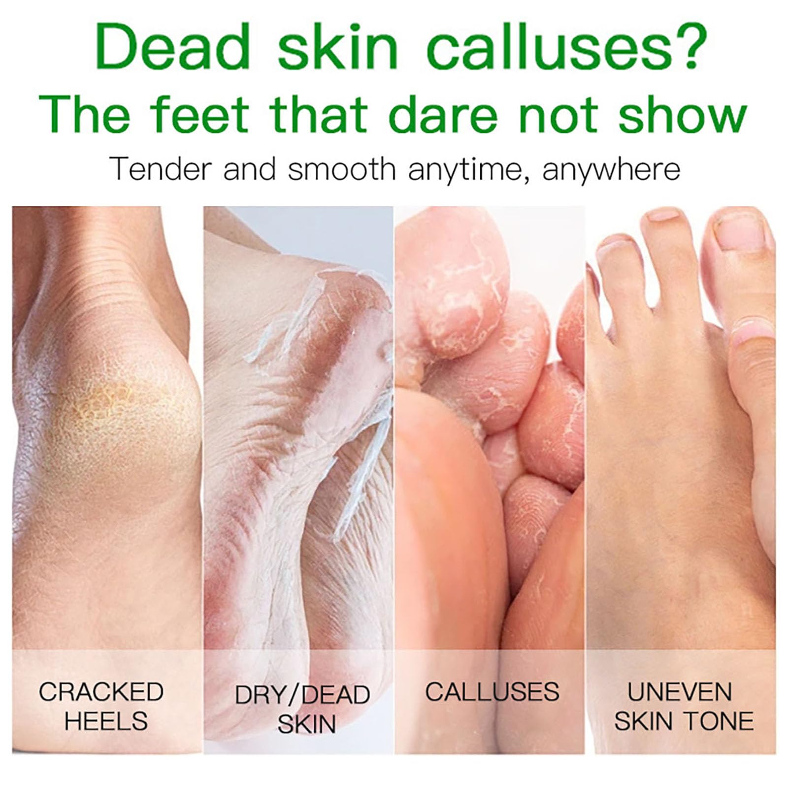 3 works Foot Peel Mask, Aloe Vera Exfoliating Foot Peel Mask, Foot Mask Peel for Dry Cracked Heels & Calluses - Image 2