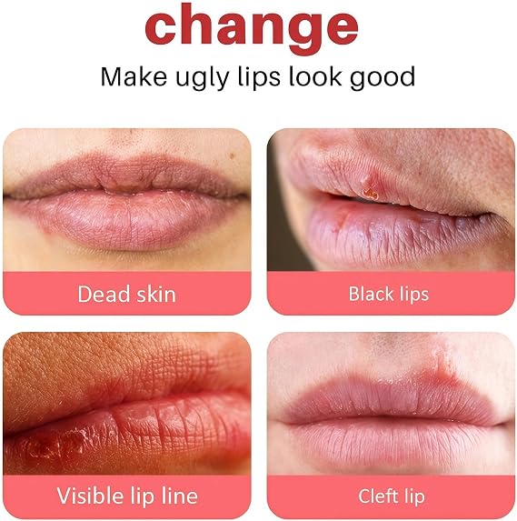 Lip Scrub, Lip Lightening Balm for Dark Lips, Moisturizing Whitening & Brightening Cream, Removes Dark Spots, Pink Lip Care, 1PCS