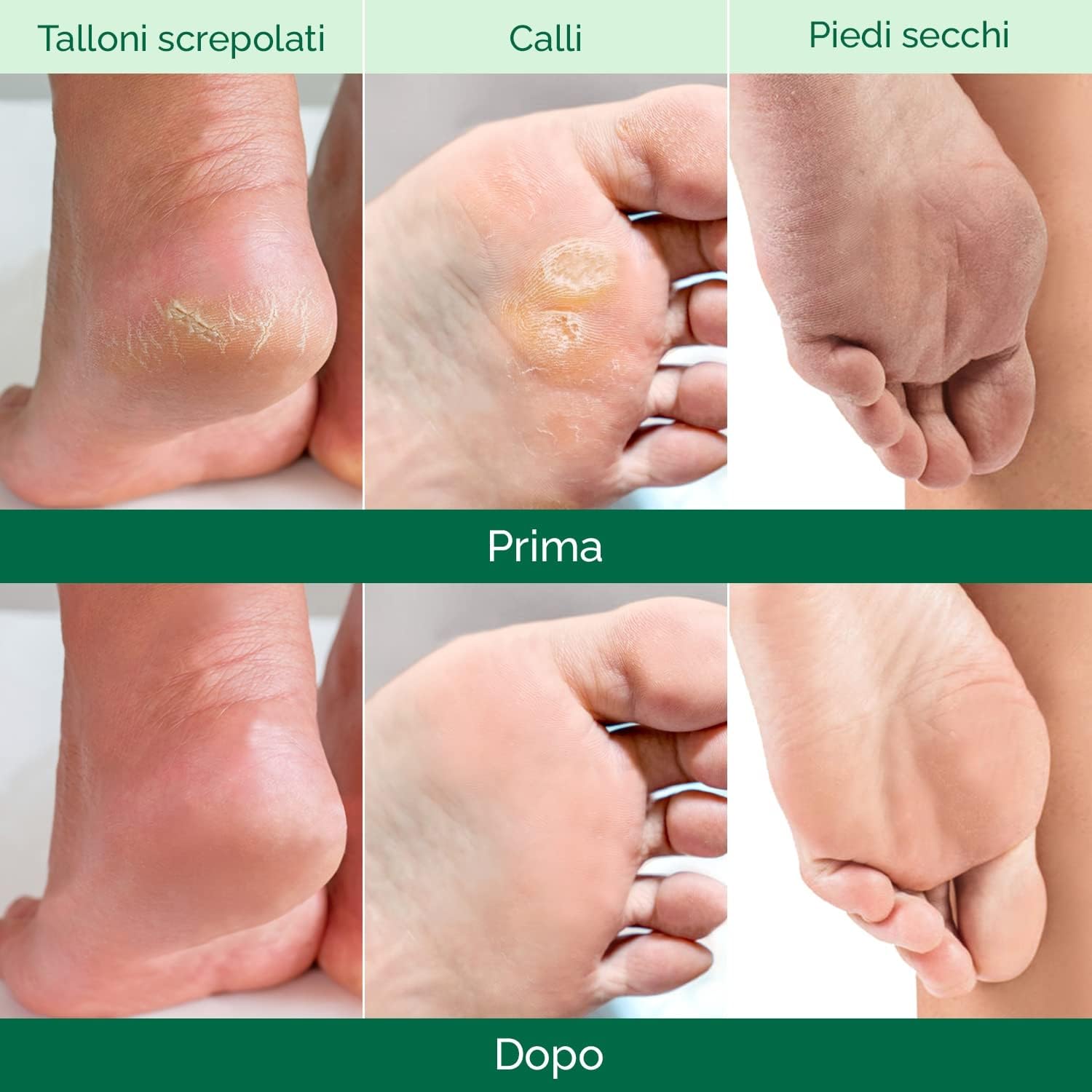 PLANTIFIQUE Maschera Piedi Esfoliante | Trattamento Calli e Duroni | Cura e Scrub Piedi | Peeling Piedi Forte | Pulizia Talloni Screpolati | Foot Peel Mask Calzini Pedicure Peel Off | Uomini 2 Paia