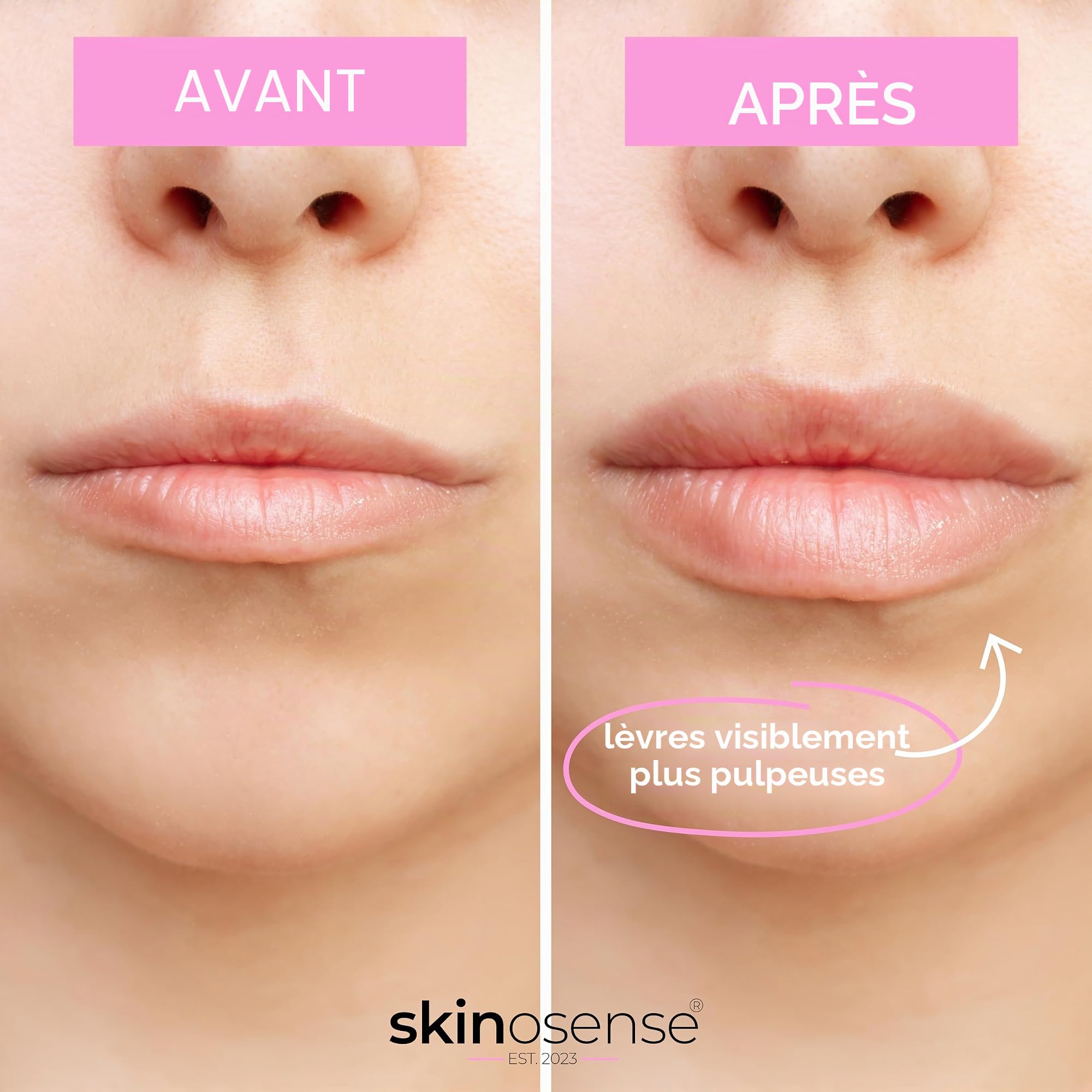 Hydra Derma Roller 3.0 avec 105 aiguilles et sérum booster les lèvres, pour des lèvres visiblement plus pulpeuses, lisse les ridules, avec ingrédients naturels, végétalien et sans cruauté