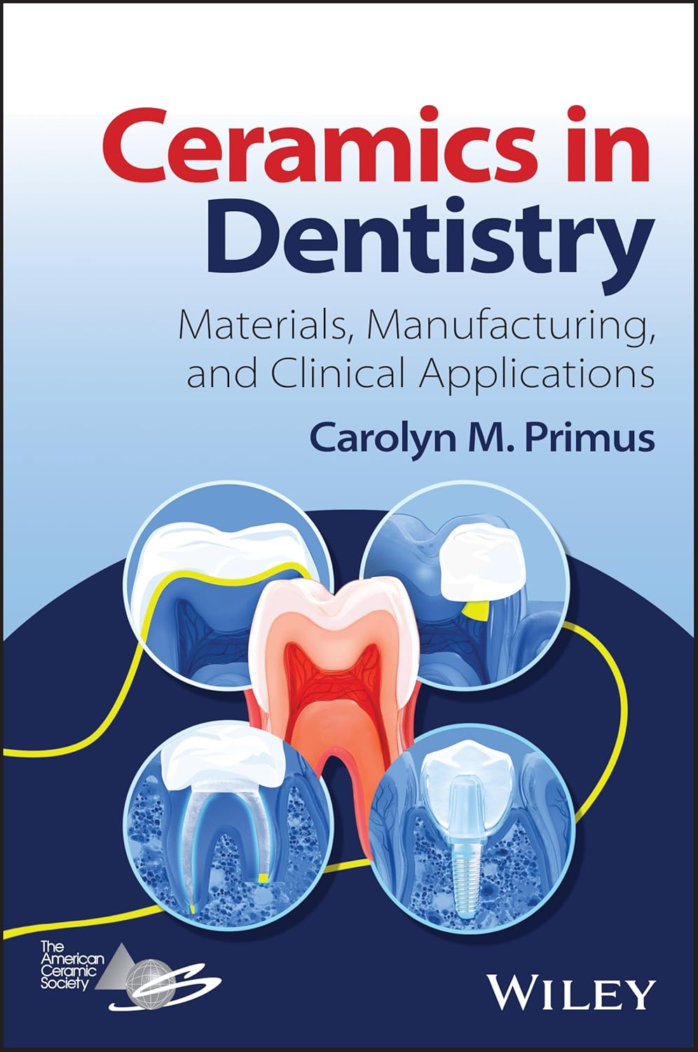 Ceramics in Dentistry : Materials, Manufacturing, and Clinical Applications