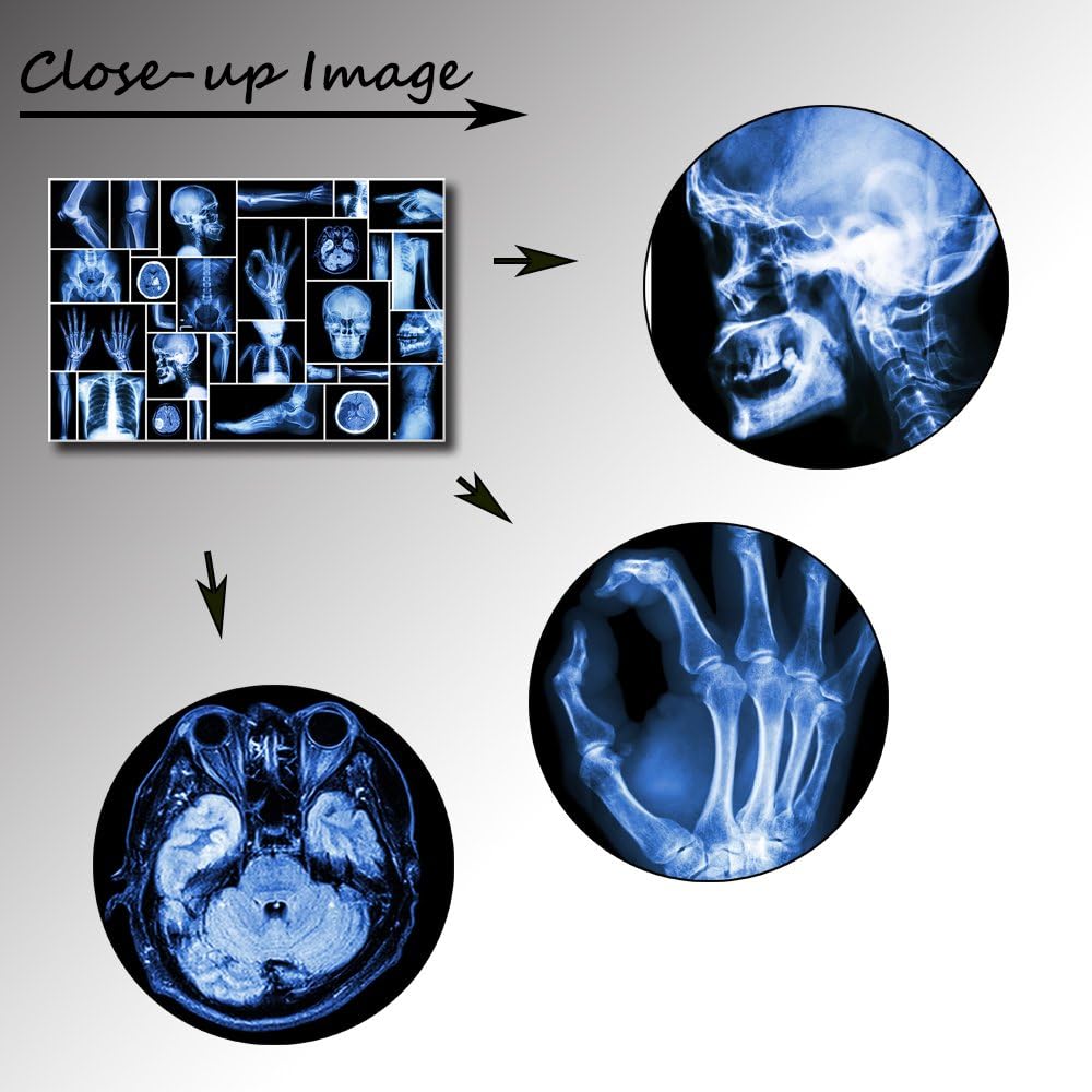 KLVOS Large Abstract Skull Canvas Art Wall Decor Black and Blue Collection Xray Multiple Part of Human Organs Gallery Wrap Canvas Prints Home Decor Giclee Print for Hospital Office Ready to Hang