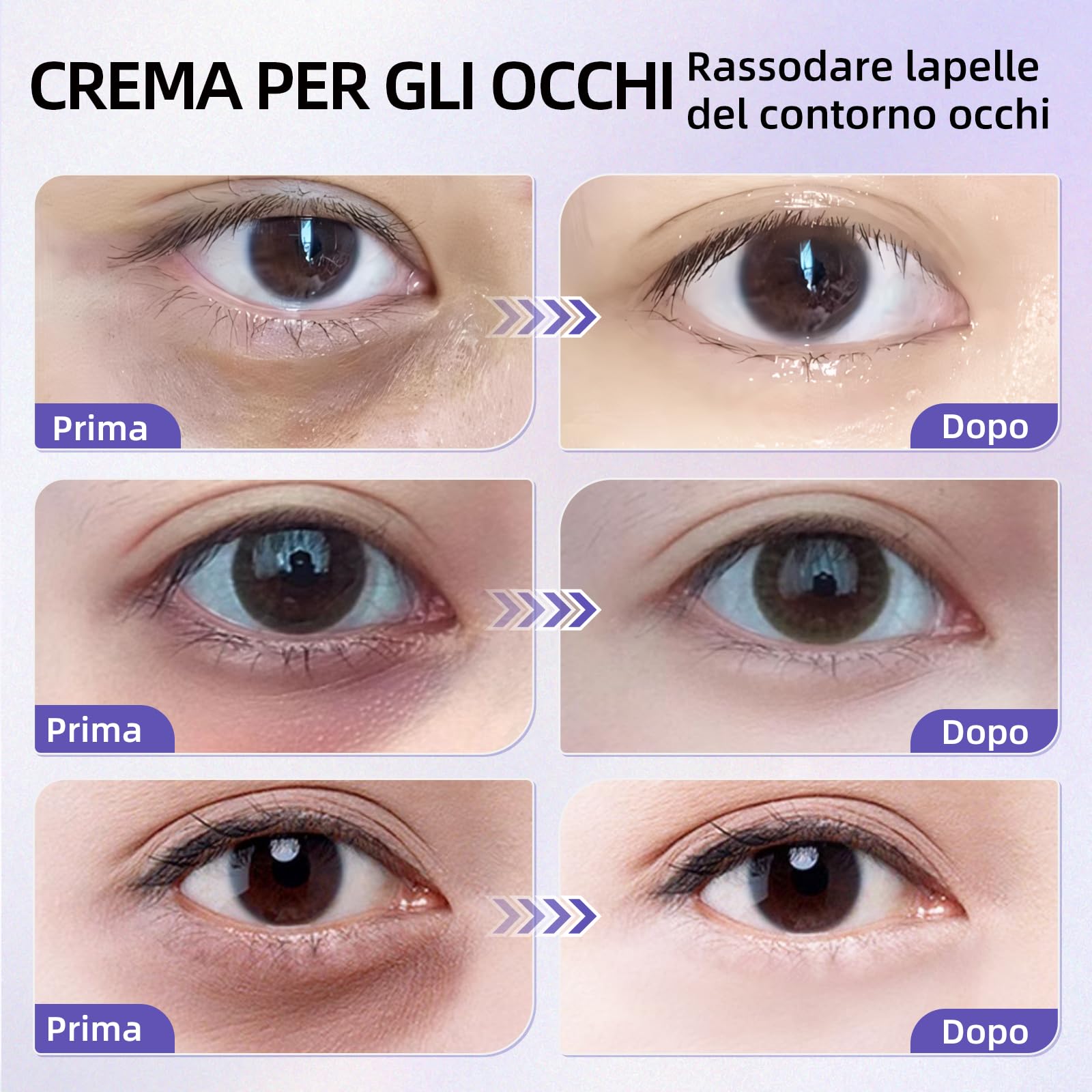 Crema Contorno Occhi alla Caffeina 20g, Riduce le Occhiaie e il Gonfiore, Contiene Niacinamide e Acido Ialuronico, Idratante, Adatta a Tutti i Tipi di Pelle
