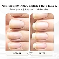Vista 5 de Fórmula fortalecedora de uñas para aumentar el crecimiento, queratina, biotina y vitamina E, sin 21 unidades, repara las uñas dañadas, detiene