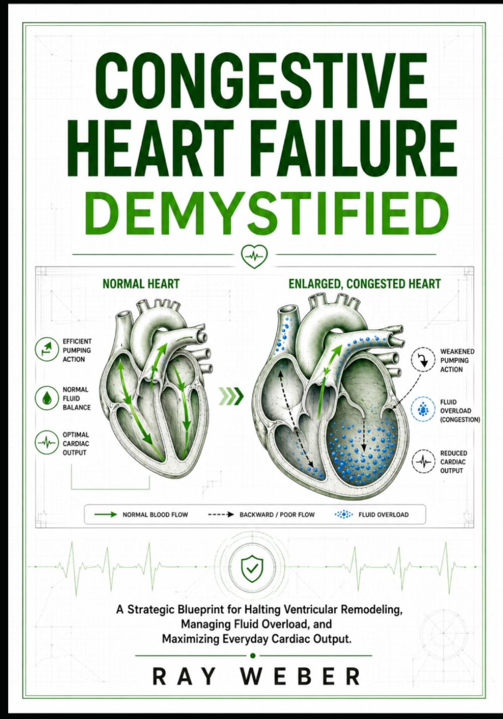Congestive Heart Failure Demystified: A Strategic Blueprint for Halting Ventricular Remodeling, Managing Fluid Overload, and Maximizing Everyday ... your heart. Protect your heart. Live longer.)