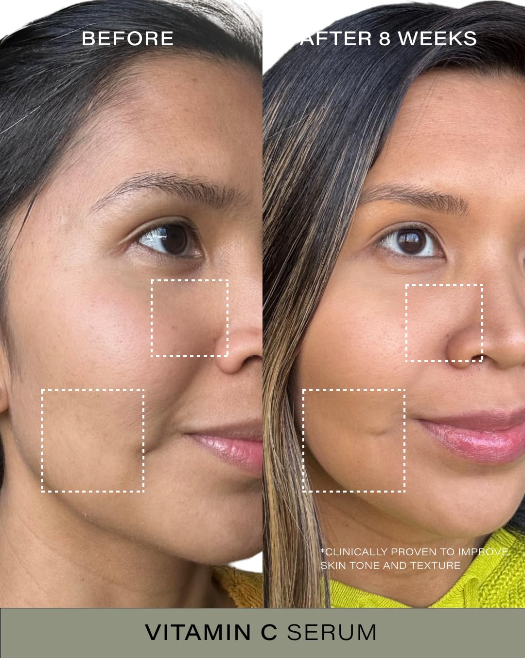 Vitamin C Serum, 1.0 Fl Oz, Dermatologist crafted skincare