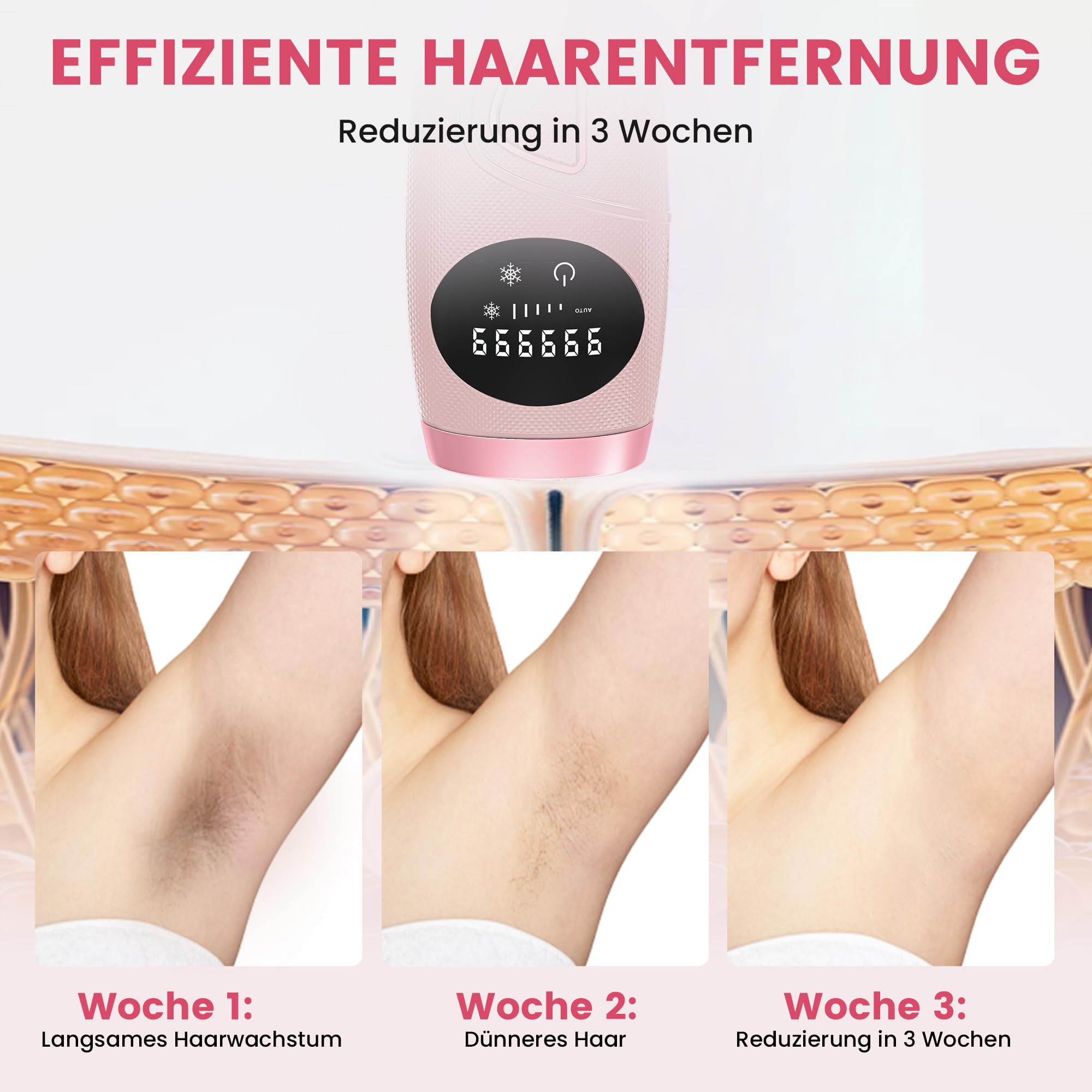 Atopskins IPL Haarentfernungsgerät, Schmerzlose Laser-Haarentfernung, 5 Intensitäten IPL Geräte Haarentfernung Und IPL Laser 2 in 1, Kann am Ganzen Körper Angewendet Werden, Inklusive IPL-Schutzbrille