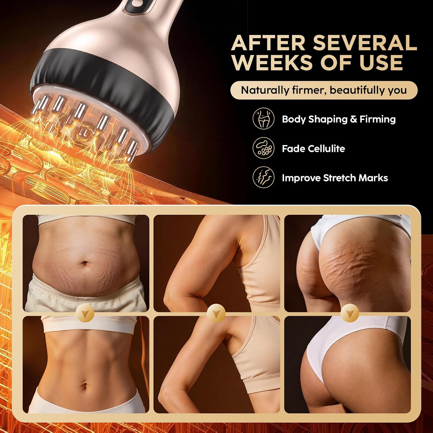 Lymphatic Drainage Massager & Anti-Cellulite Massage Tool, Body Sculpting Device for Legs, Arms & Stomach, Supports Smoother Skin, with Gentle Warming & Vibration (Rosegold) image 5