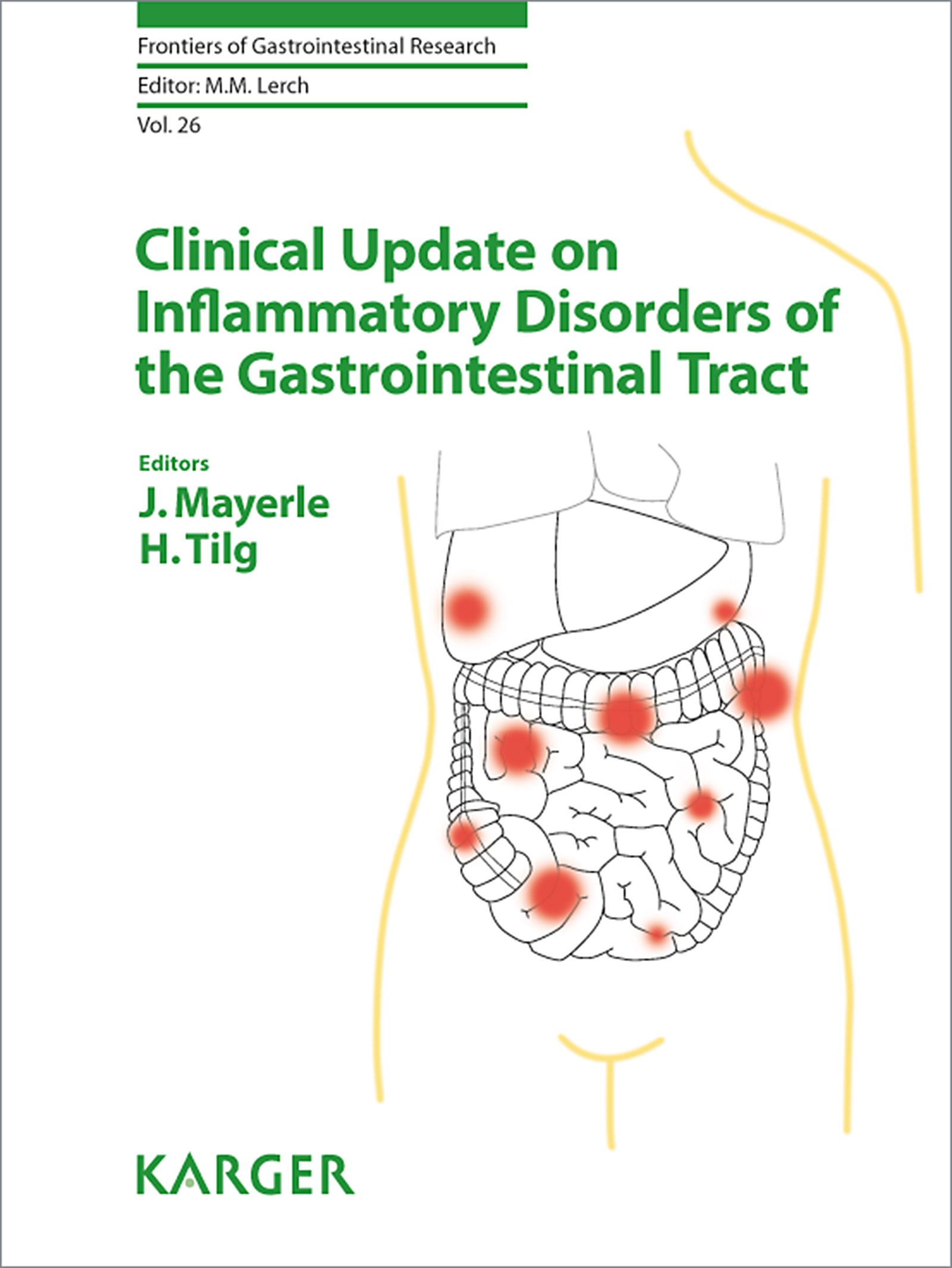 Clinical Update on Inflammatory Disorders of the Gastrointestinal Tract (Frontiers of Gastrointestinal Research Book 26)