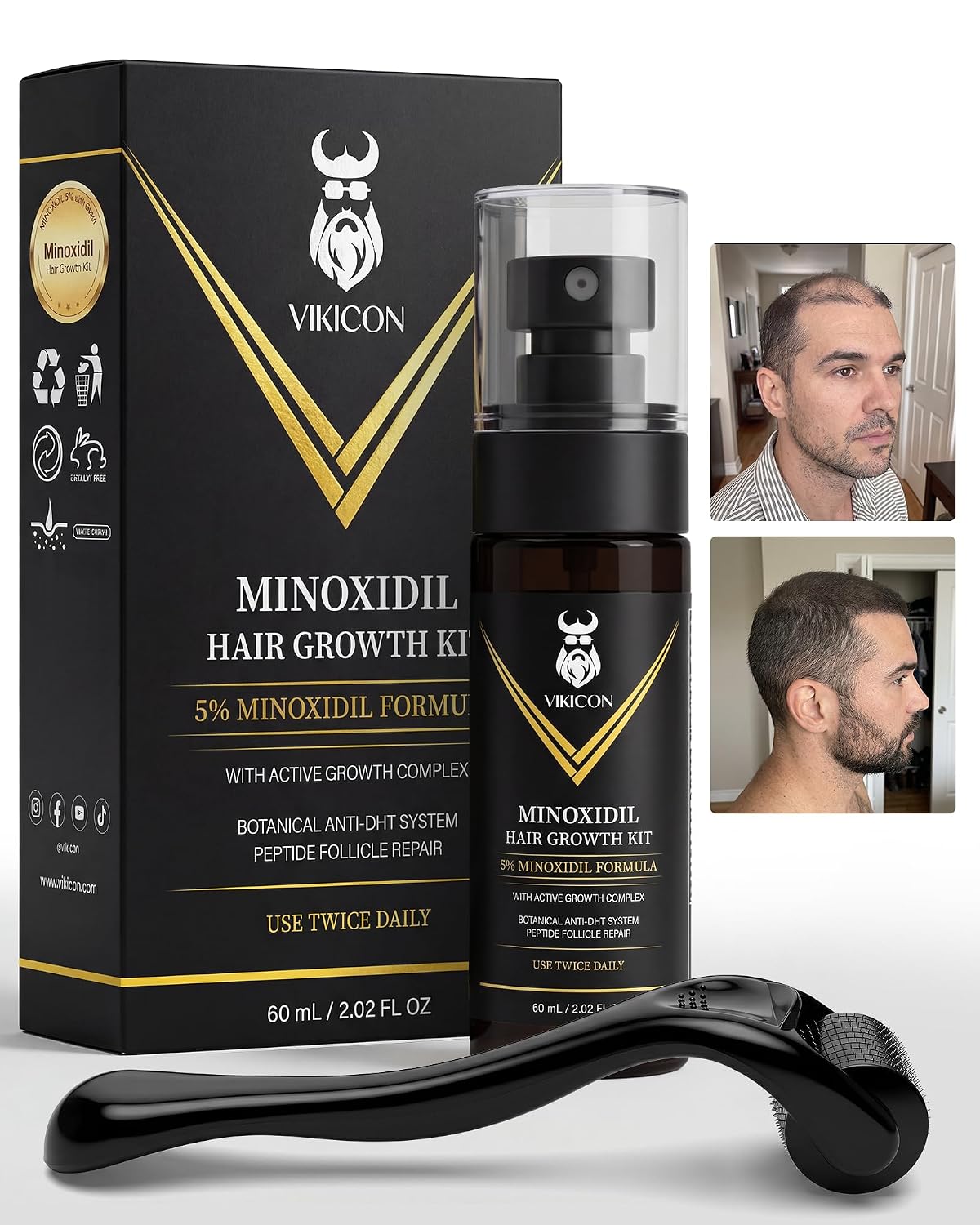 5% Minoxidil for Men Beard Growth, Patchy Hair & Beard Growth Spray Kit