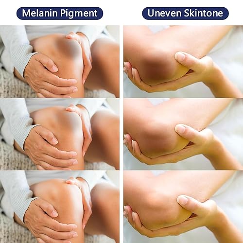 Miniatura 7 de Crema para aclarar la piel Suero Crema blanqueadora de la piel Crema blanqueadora para el área íntima del cuerpo, partes privadas, axilas, rodillas,