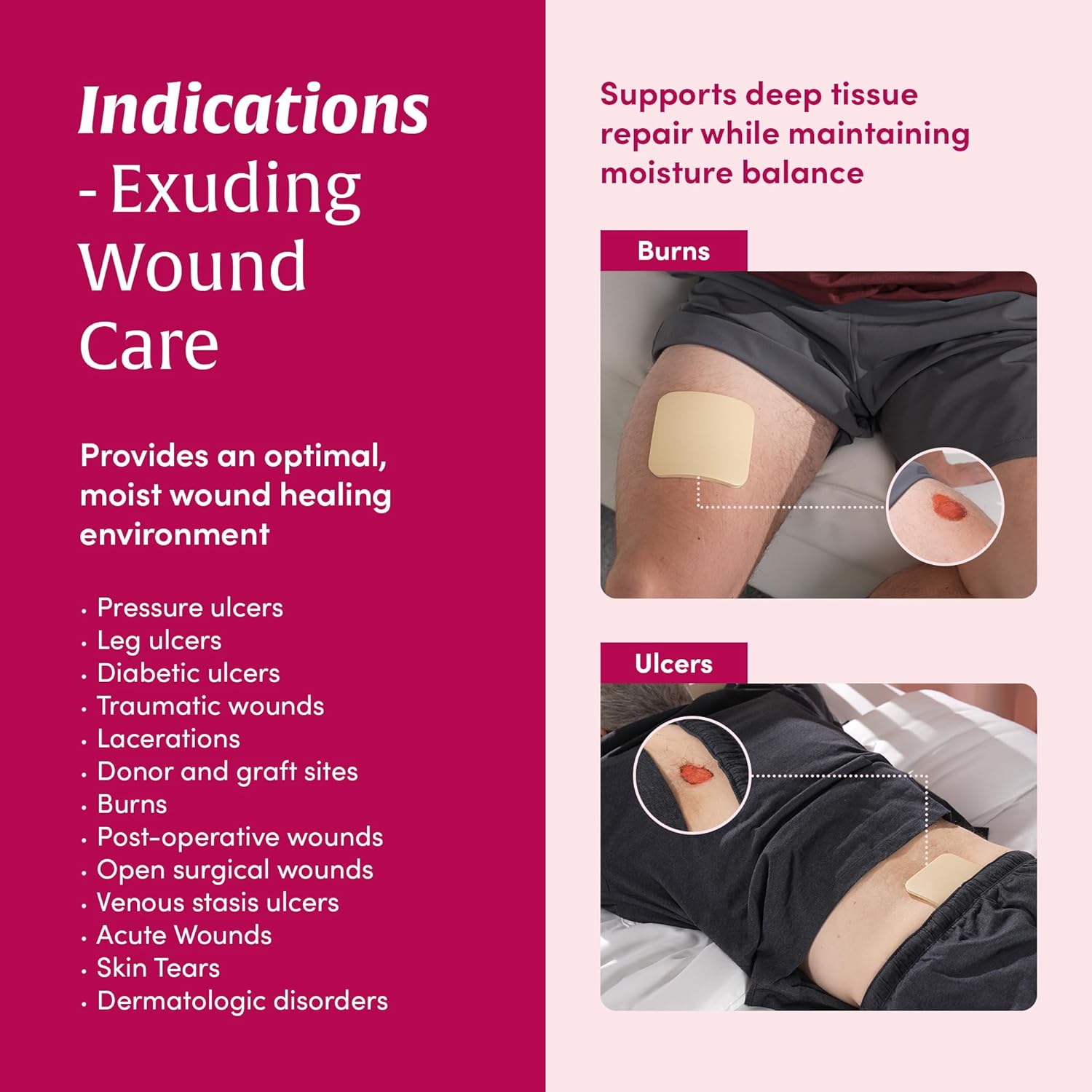 Hydrophilic Foam Dressing, Non-Adhesive, Foam Dressing for High exudate Wounds, 4in x 4in (10sheets) - Image 5