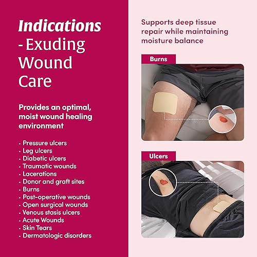 Miniatura 5 de Apósito de espuma hidrofílica, no adhesivo, apósito de espuma para heridas de alto exudado, 4 x 4 pulgadas (10 hojas)