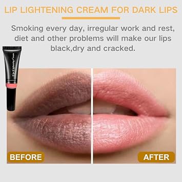 2 PCS Lip Lightening Cream for Dark Lips - Natural Brightening Lip Balm with Alpha-arbutin & Vitamin E,Long Lasting Hydrating Lip Pigmentation Corrector for Women & Men,Vegan Overnight Mask,Not Sticky