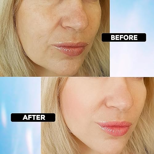 Miniatura 3 de +1HEROLABS Suero de ácido hialurónico para rostro antienvejecimiento, líneas finas, manchas oscuras y piel seca, suero facial hidratante, el mejor