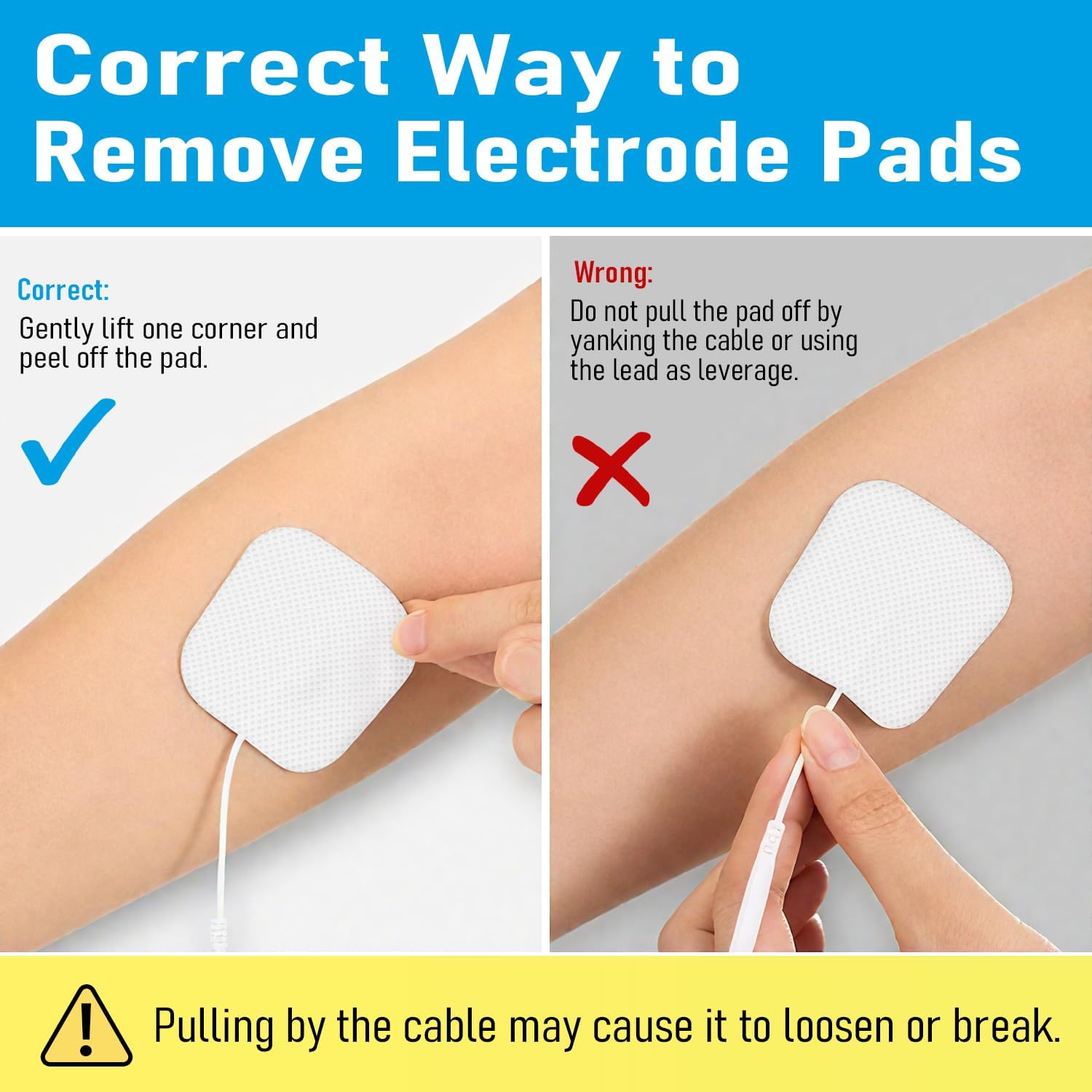 Image illustrating the correct way to remove an electrode pad by gently peeling from a corner, and the incorrect way by pulling the wire.